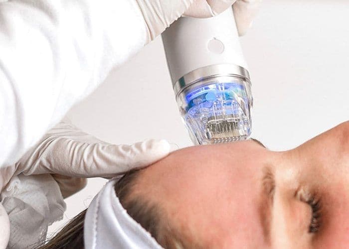 MNRF for Scars